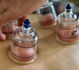5 jours en retraite de médecine traditionnelle chinoise et de guérison orientale à Bali, Indonésie - Photo 3